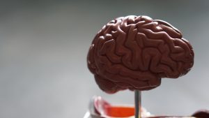 Higher Dementia Risk